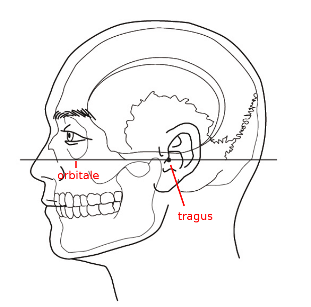 3142997_Head-alignment-according-to-the-Frankfurt-plane.png