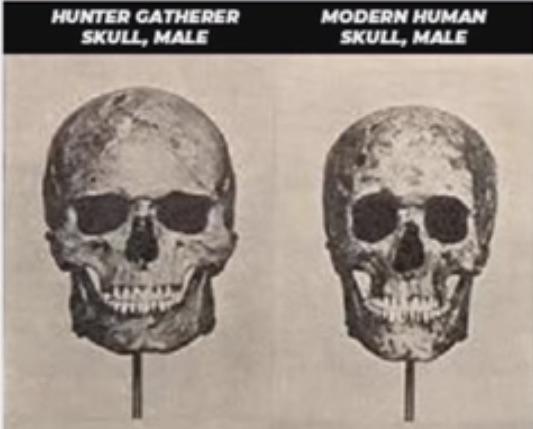 Image result for hunter gatherer skull vs modern