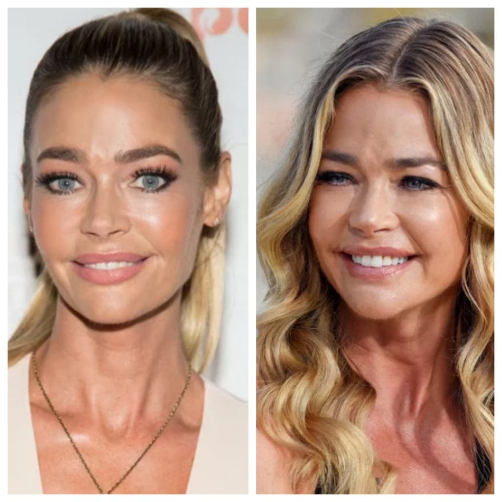 Denise-Richards-Before-and-After.jpg