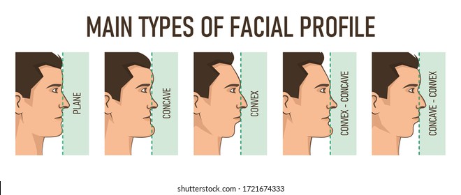 main-types-facial-profile-convex-260nw-1721674333.jpg