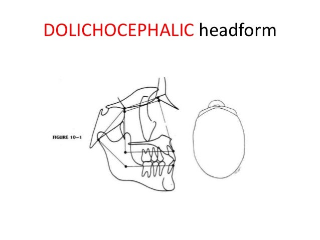 cranial-base-angle-in-relation-to-malocclusion-31-638.jpg