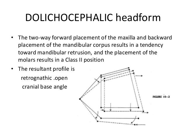 cranial-base-angle-in-relation-to-malocclusion-32-638.jpg