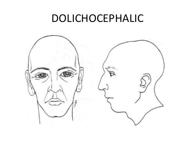 cranial-base-angle-in-relation-to-malocclusion-33-638.jpg