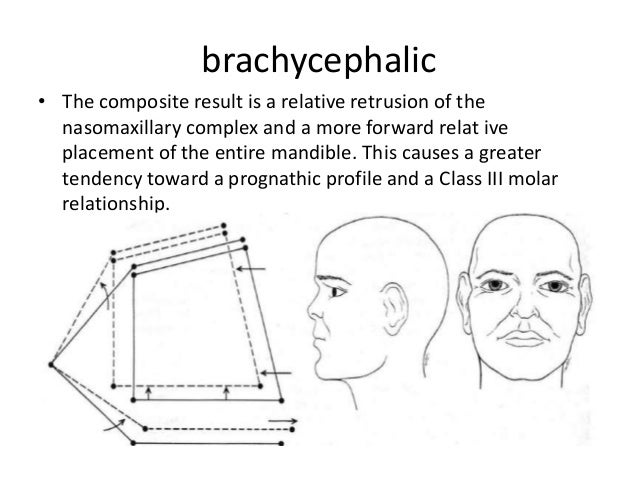 cranial-base-angle-in-relation-to-malocclusion-35-638.jpg