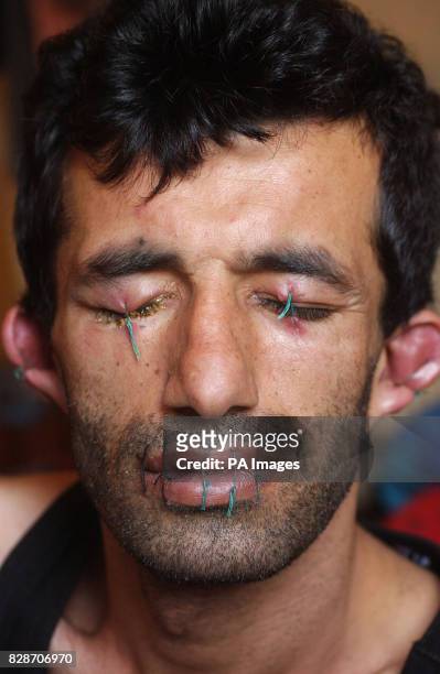 iranian-refugee-abas-amini-who-has-stitched-his-lips-eyes-and-ears-together-and-is-on-hunger.jpg