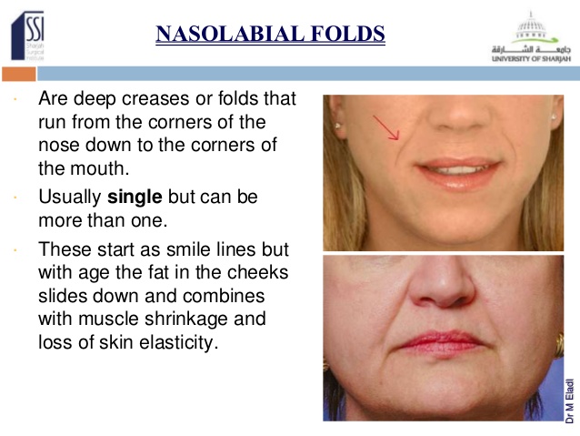 [Image: essential-anatomy-for-facial-injections-...1401049246]